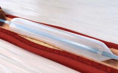 The Latest Treatments for Peripheral Artery Disease (PAD)