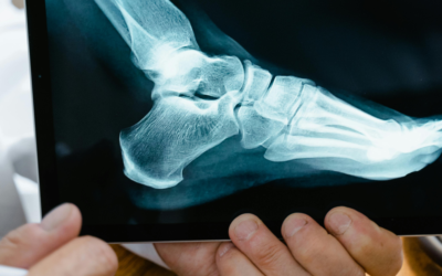 How Regular Check-ups Can Prevent Wound Complications