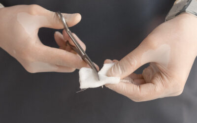 Overcoming the Challenges of Vascular Wound Care, Improving Healing and Preventing Complications
