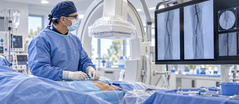 Angioplasty, stenting, and atherectomy treatment for Peripheral Artery Disease