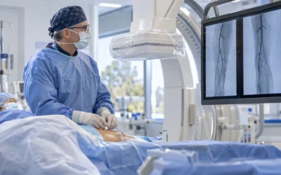 Minimally Invasive Procedures for Peripheral Artery Disease – Restoring Blood Flow Without Major Surgery